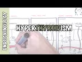 Hyperthyroidism Overview causes pathophysiology
