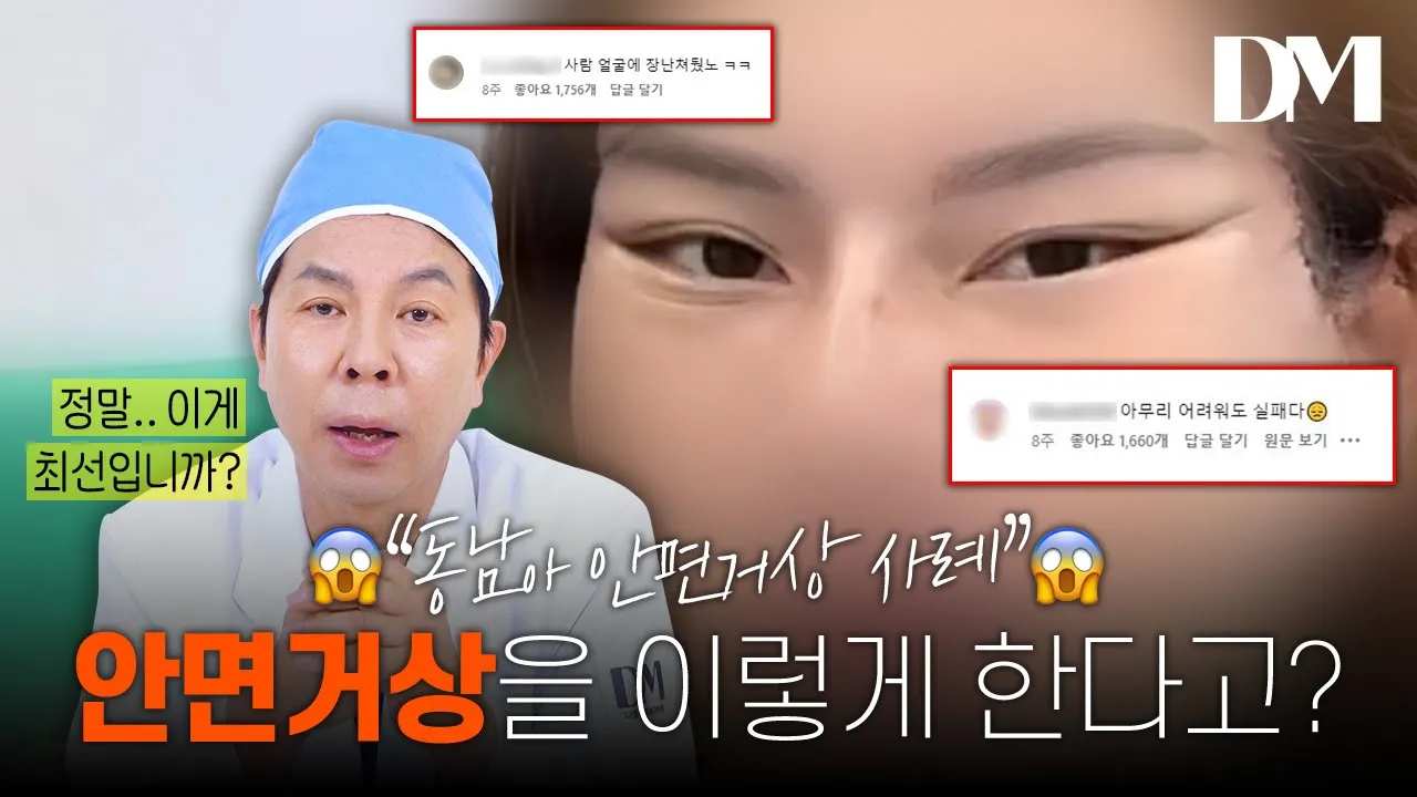 안면거상은 무조건 과하게 당긴다고 잘 된게 아닙니다!! 이건 꼭 봐주세요!! #안면거상 #안면거상부작용 #리프팅