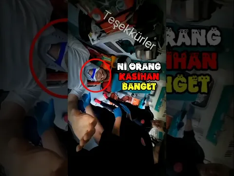 Kakinya Patah! 🤕