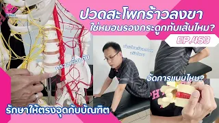 อาการปวดที่สะโพกและร้าวลงขาอาจเกิดจากสาเหตุอะไรบ้าง