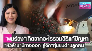 โรคใดที่มีความเสี่ยงทำให้ผมร่วงได้บ่อย