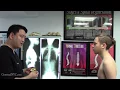 Download Lagu Scoliosis, chronic fatigue syndrome, heartburn, GERD, headache, sinus infections - Gonstead