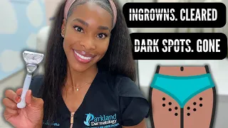 how to get the perfect bikini line no more dark spots ingrown hairs or bumps 