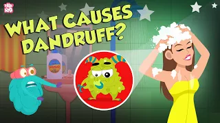 Download What Causes Dandruff | How To Treat Dandruff  | The Dr Binocs Show | Peekaboo Kidz MP3