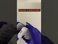 Tramadol hydrochloride made simple