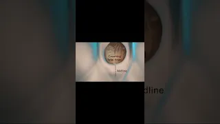 شاهد شق العجان أثناء الولادة الطبيعية Nurse تمريض نساء وولادة الولادة القيصرية ولادة طفل طب 