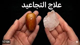 ضع الشبة على التمر ولن تصدق النتائج قبل العيد مدهشة أقسم بالله ندمت إني معرفتها من زمان جربيها بنفسك