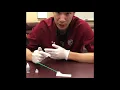 Rapid Strep Test