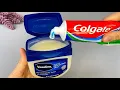 Just Mix Toothpaste with Vaseline And You Will Be Amazed