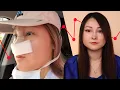 I Got Plastic Surgery And I Regret It This Is That Story BuzzFeed