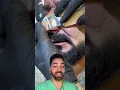 Doctorly Explains Nose Gunk Shorts
