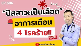 อาการของกระเพาะปัสสาวะอักเสบมีอะไรบ้าง