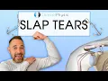 Superior Labral Anterior Posterior Tears Everything you need to know about SLAP tears