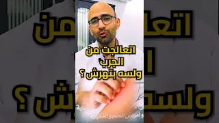 علاج الجرب ممكن يسبب اكزيما و هرش    دندنها