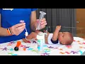 UCSF Pediatric Surgery Gastrostomy Tube Teaching