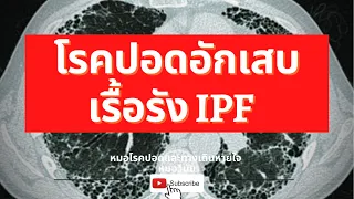  การวินิจฉัยไอพีเอฟใช้วิธีใดบ้าง และจำเป็นต้องตัดชิ้นเนื้อไหม 