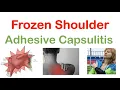 Frozen Shoulder (Adhesive Capsulitis): Causes, Symptoms, Stages, Diagnosis, Treatment