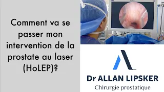 lholep ou chirurgie de la prostate au laser expliqu e aux patients
