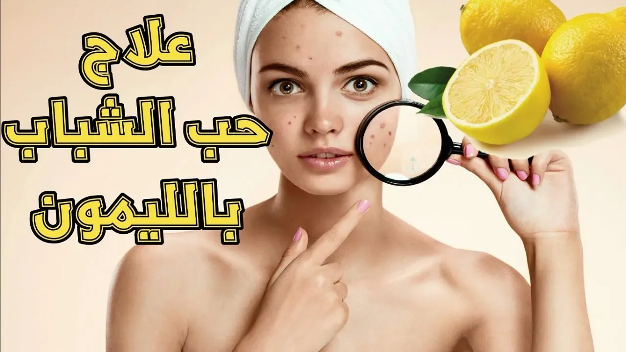 علاج حب الشباب  سريعا بأقوى مجربه. 