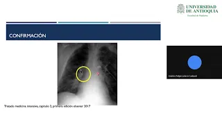 Monitoreo Hemodinámico en UCI - Dr. Andres Felipe Lotero