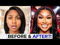 Ari Fletcher REVEALS Truth About Her Most PAINFUL Surgery Recovery She s Out of CONTROL