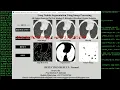 Lung Nodule Identification Using Image Processing With Source Code Python Tensorflow OpenCv Project