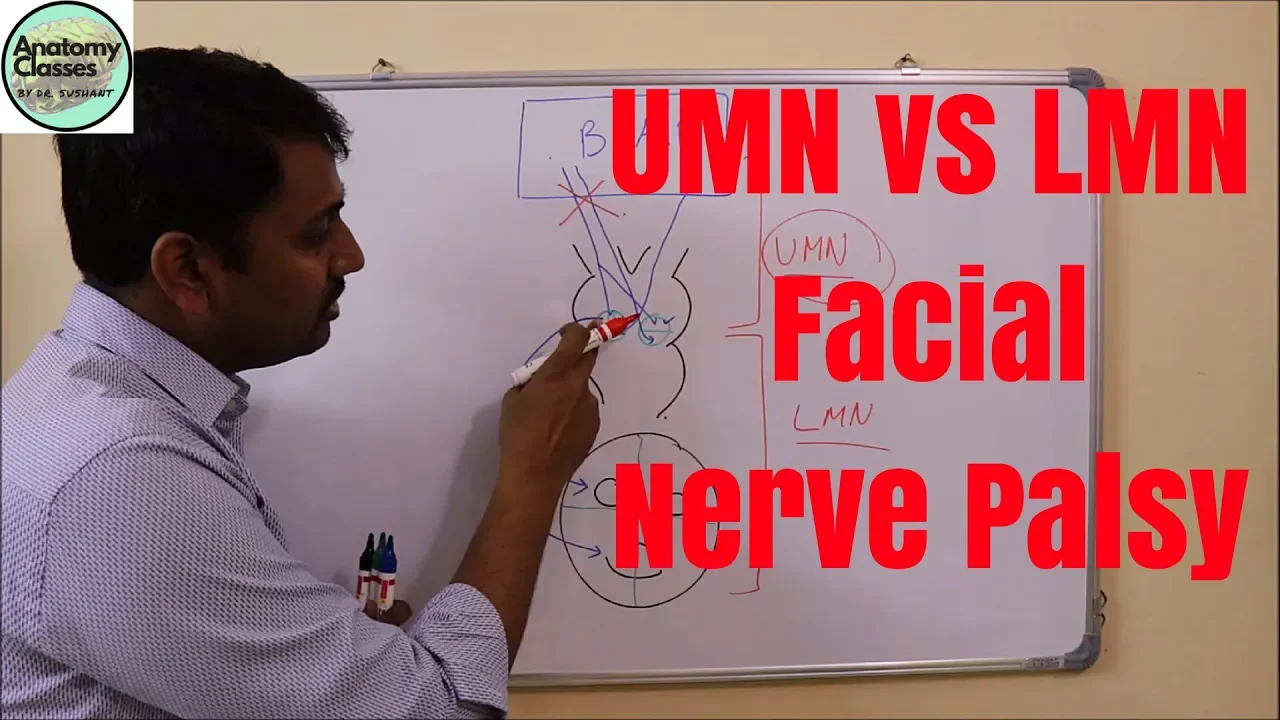 UMN vs LMN lesion of Facial Nerve