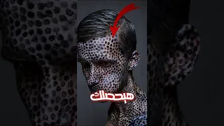 هذا ما سيحدث لك اذا ابتلعك حوت ازرق  هذا ما سيحدث لك اذا ابتلعك حوت ازرق