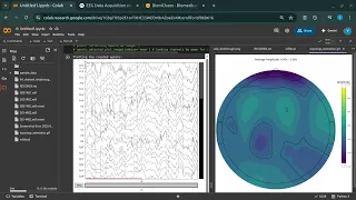 Power Spectral Density Top-Map Visualization An Advanced MNE-Python Workflow for EEG Data