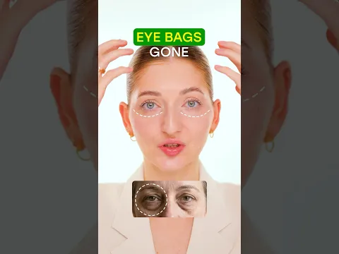 Eye Bags Gone | Face Fitness | Face Yoga | Face Massage