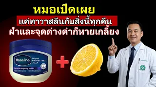 จุดด่างดำในผู้สูงอายุเกิดจากสาเหตุหลักอะไร และทำไมจึงสะสมมากขึ้นเมื่ออายุเพิ่มขึ้น
