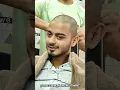 Crazy Full Hair Removal Bald Look in Summer