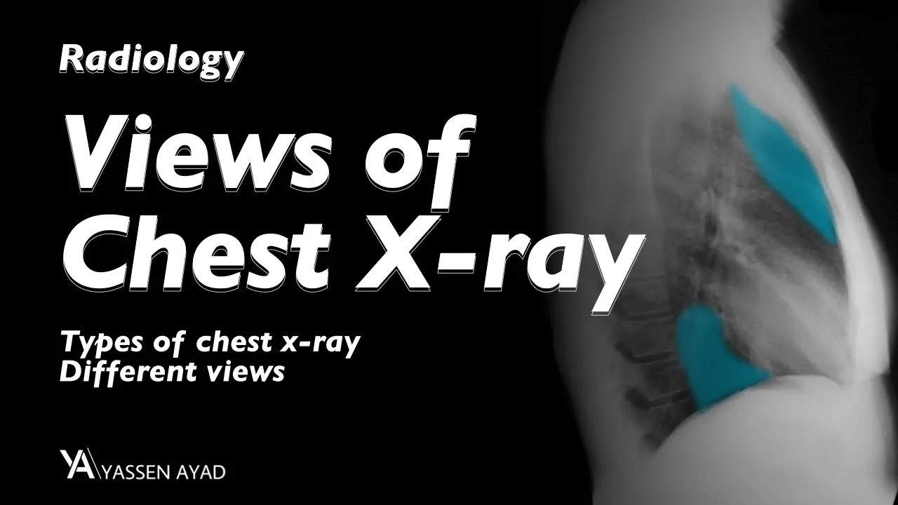 Radiology 3 | Views of Chest X-ray
