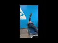 Sural Nerve Glide