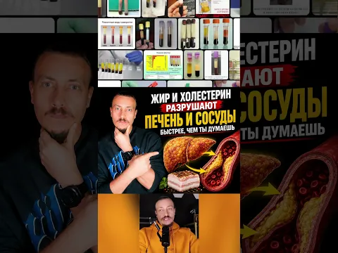 Жир и холестерин разрушают печень и сосуды быстрее, чем ты думаешь