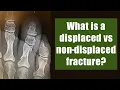 What is a displaced vs non-displaced fracture