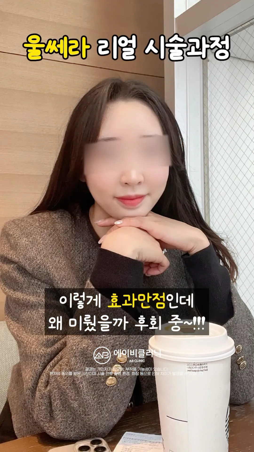 늘어진 턱살 울쎄라로 정리하기❤️‍🔥