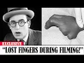 Download Lagu Golden Age Stars Who Secretly Hid Deformities and Disabilities