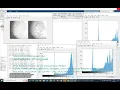 Contrast Limited Adaptive Histogram Equalization for mammography images Matlab - CLAHE-P RESEARCH