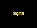 What Is The Definition Of Sagittal Medical School Terminology Dictionary