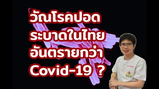 วัณโรคเกิดจากเชื้ออะไร และมีชื่อทางการว่าอย่างไร