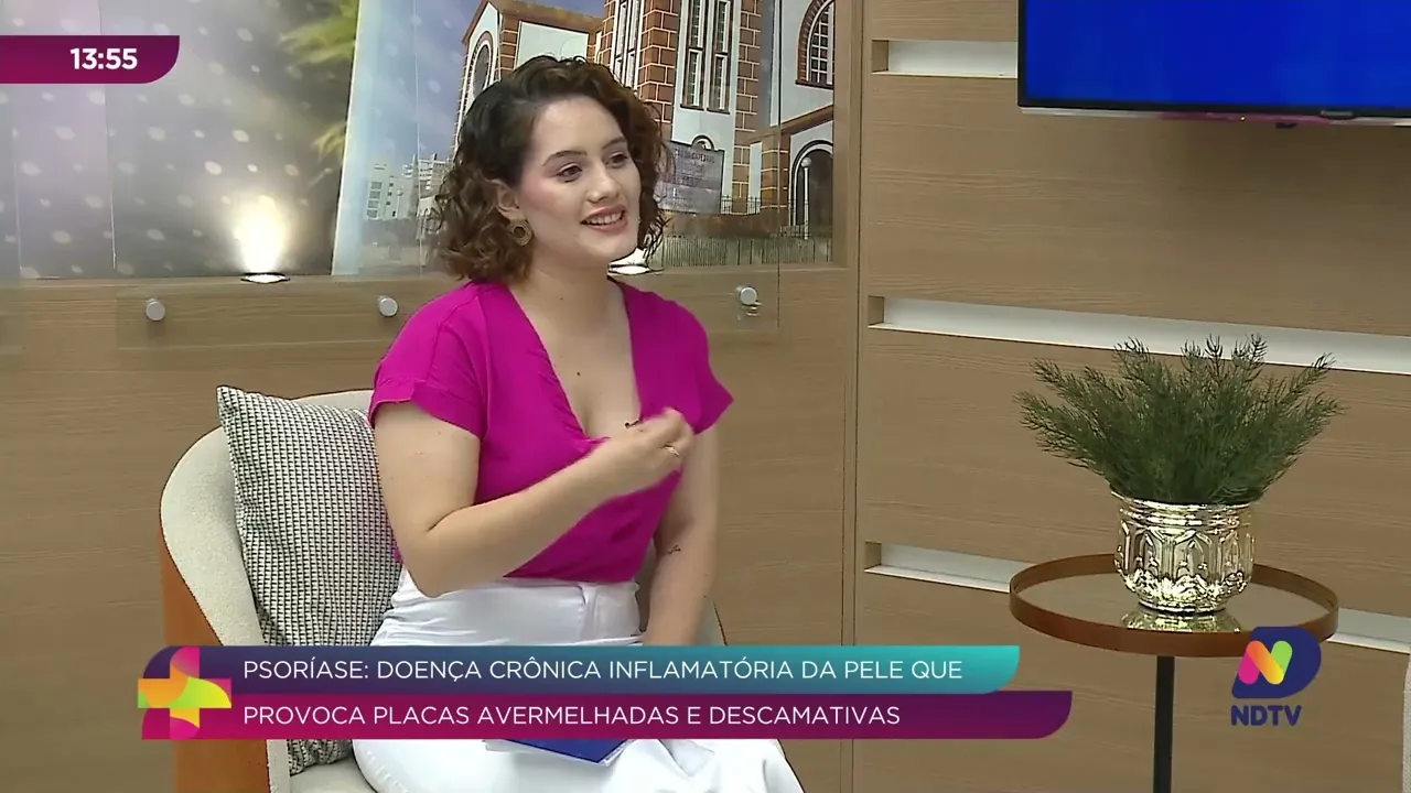 Psoríase: Entenda a Doença Crônica Inflamatória da Pele
