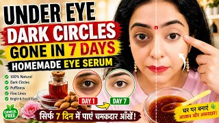 7 दिन में Under Eye Dark Circles कम करें 😱 | Homemade Eye Serum | Dark Circles का आसान इलाज