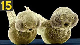 Download 15 Amazing Things Seen Under a Microscope MP3