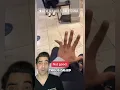 Finger Dislocation