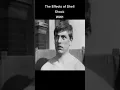 Download Lagu The Effects of Shell Shock #worldwar #soldiers #history #oldfootage #shorts