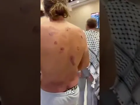 اعتدائات جنسـ ـية وجسدية علي ناشطات اسطول الصمود شاهد الفيديو كامل 👇