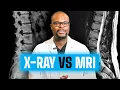 MRI vs X Ray What s the difference