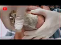 Download Lagu Beard Hair Pulling Hair Waxing Stress Relief Pleasure Skin Beauty Skin Care Men 수염왁싱 털뽑기 #shorts