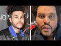 Unrecognizable Celebrities Who Had TOO Much Plastic Surgery